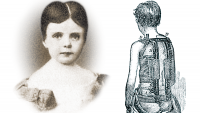 (Left to Right) Anna "Bamie" Roosevelt and Dr. Charles F. Taylor's "spinal assistant."