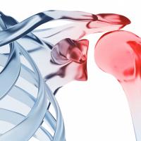 An x-ray image of a shoulder.