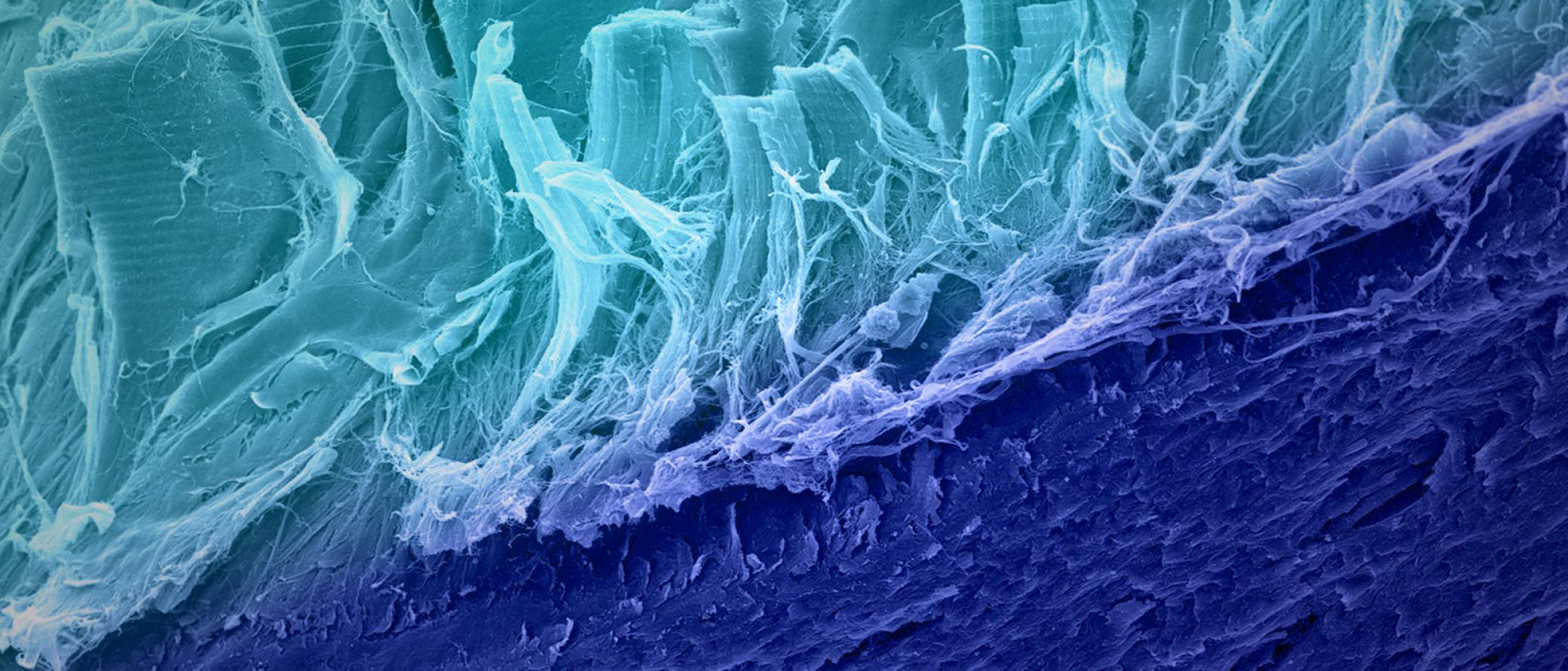 Enthesitis treatment image